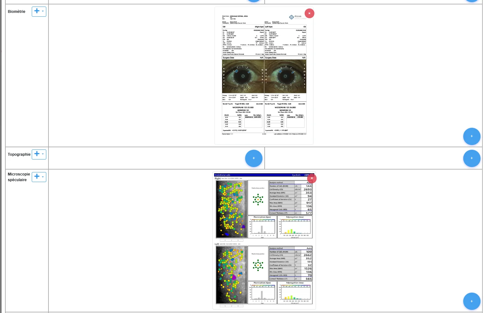Examens spécialisés biométrie topographie microscopie